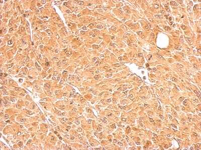 Immunohistochemistry-Paraffin: GALM Antibody [NBP2-16593]