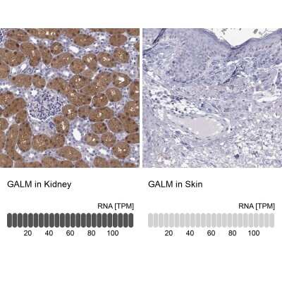 Immunohistochemistry-Paraffin: GALM Antibody [NBP2-62645]