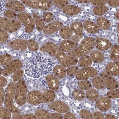 Immunohistochemistry-Paraffin: GALM Antibody [NBP2-62645]