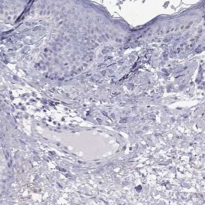 Immunohistochemistry-Paraffin: GALM Antibody [NBP2-62645]