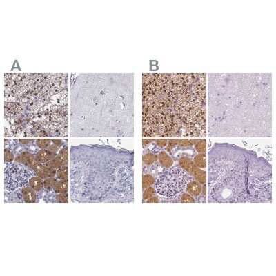 Immunohistochemistry-Paraffin: GALM Antibody [NBP2-62645]