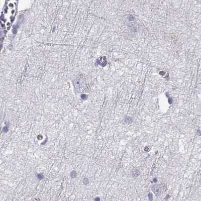 Immunohistochemistry-Paraffin: GALM Antibody [NBP2-62645]