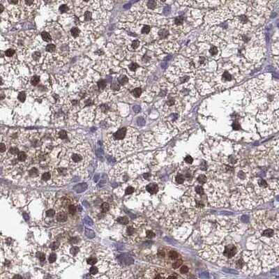 Immunohistochemistry-Paraffin: GALM Antibody [NBP2-62645]
