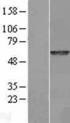 Western Blot: N-Acetylgalactosamine-6-Sulfatase/GALNS Overexpression Lysate [NBL1-10952]