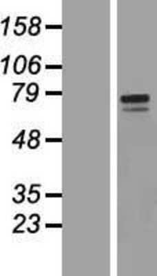 Western Blot: Polypeptide GalNac Transferase 10/GALNT10 Overexpression Lysate [NBP2-04725]