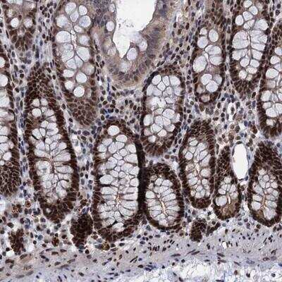 Immunohistochemistry-Paraffin: GALNT11 Antibody [NBP1-82140]