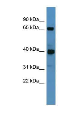 Western Blot: GALNT11 Antibody [NBP1-69008]