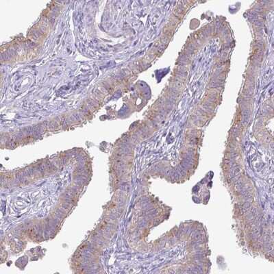 Immunohistochemistry-Paraffin: GALNT12 Antibody [NBP2-14035]