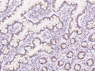 Immunohistochemistry-Paraffin: GALNT12 Antibody [NBP2-97733]