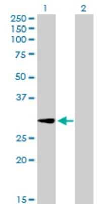 Western Blot: GALNT12 Antibody [H00079695-B01P]