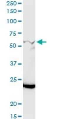 Western Blot: GALNT12 Antibody [H00079695-D01P]