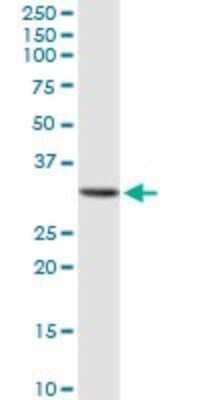 Western Blot: GALNT12 Antibody [H00079695-D02P]