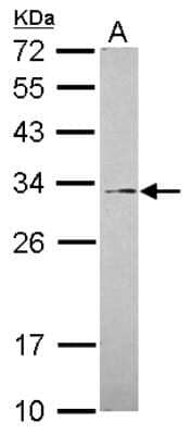 Western Blot: GALNT12 Antibody [NBP2-16594]