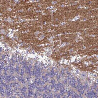 Immunohistochemistry-Paraffin: GALNT13 Antibody [NBP2-31837]