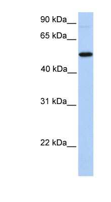 Western Blot: GALNT13 Antibody [NBP1-62619]