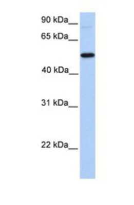 Western Blot: GALNT13 Antibody [NBP1-69624]