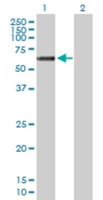 Western Blot: GALNT14 Antibody [H00079623-B01P]