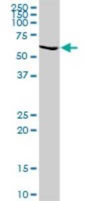 Western Blot: GALNT14 Antibody [H00079623-D01P]