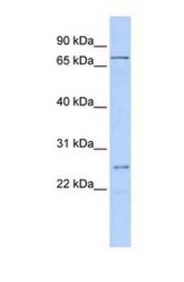 Western Blot: GALNT14 Antibody [NBP1-69611]