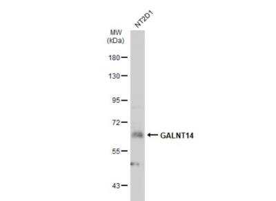 Western Blot: GALNT14 Antibody [NBP2-16595]