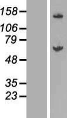 Western Blot: GALNT14 Overexpression Lysate [NBL1-10953]