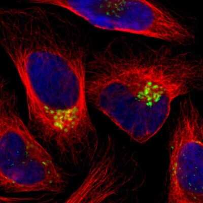 Immunocytochemistry/ Immunofluorescence: GALNT2 Antibody [NBP1-83394]