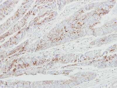 Immunohistochemistry-Paraffin: GALNT2 Antibody [NBP1-32394]