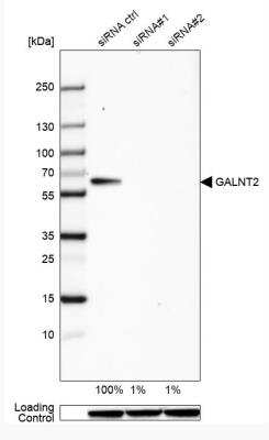 Western Blot: GALNT2 Antibody [NBP1-83394]