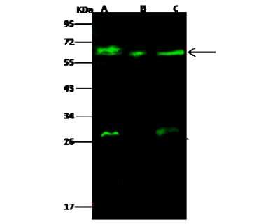 Western Blot: GALNT2 Antibody [NBP3-00188]