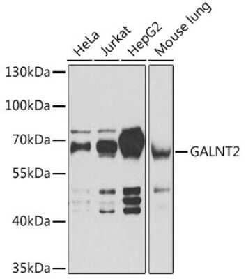 Western Blot: GALNT2 AntibodyBSA Free [NBP3-05041]