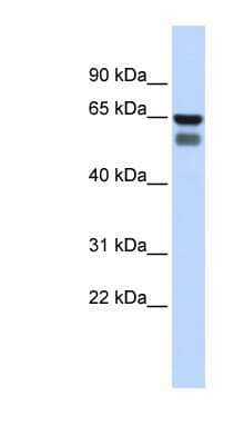 Western Blot: Polypeptide GalNac Transferase 4/GALNT4 Antibody [NBP1-62381]