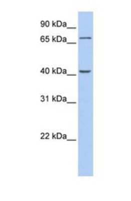 Western Blot: Polypeptide GalNac Transferase 4/GALNT4 Antibody [NBP1-69399]