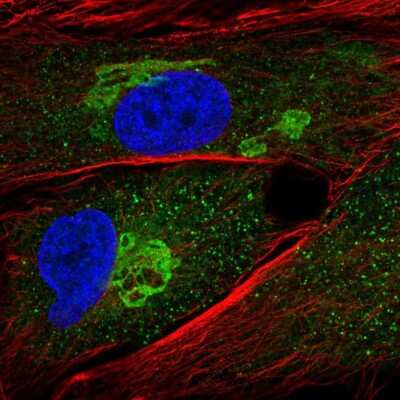 Immunocytochemistry/ Immunofluorescence: GALNT5 Antibody [NBP1-86483]