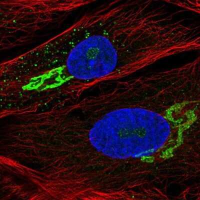 Immunocytochemistry/ Immunofluorescence: GALNT5 Antibody [NBP1-86484]