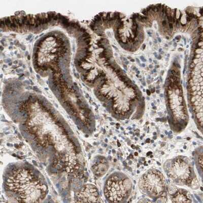 Immunohistochemistry-Paraffin: GALNT5 Antibody [NBP1-86483]