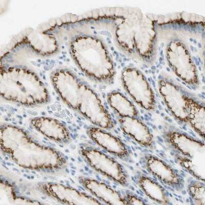 Immunohistochemistry-Paraffin: GALNT5 Antibody [NBP1-86484]