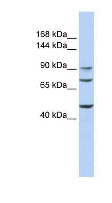 Western Blot: GALNT5 Antibody [NBP1-62372]