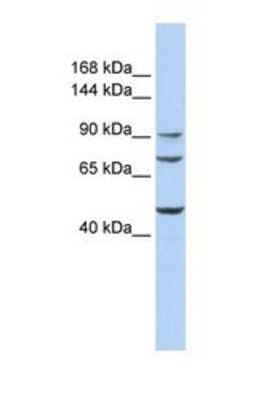 Western Blot: GALNT5 Antibody [NBP1-69393]