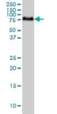 Western Blot: GALNT6 Antibody (4C10) [H00011226-M01]