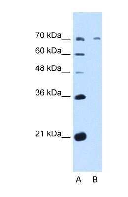 Western Blot: GALNT6 Antibody [NBP1-69641]