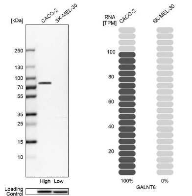 Western Blot: GALNT6 Antibody [NBP1-86100]