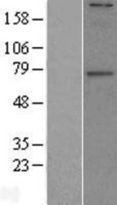 Western Blot: GALNT6 Overexpression Lysate [NBL1-10957]