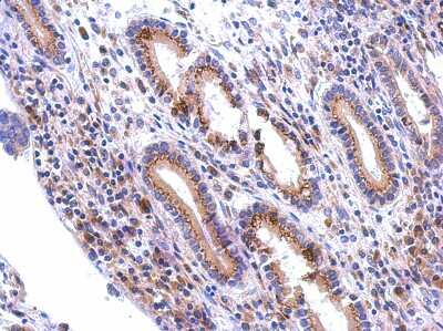 Immunohistochemistry-Paraffin: Polypeptide GalNac Transferase 7/GALNT7 Antibody [NBP2-16597]