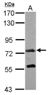 Western Blot: Polypeptide GalNac Transferase 7/GALNT7 Antibody [NBP2-16597]