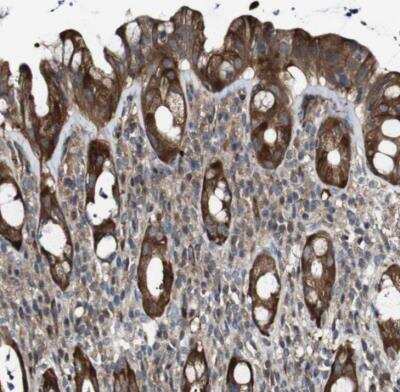 Immunohistochemistry-Paraffin: GALNT8 Antibody [NBP1-81848]