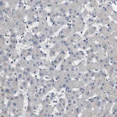 Immunohistochemistry-Paraffin: GALNT8 Antibody [NBP1-81848]