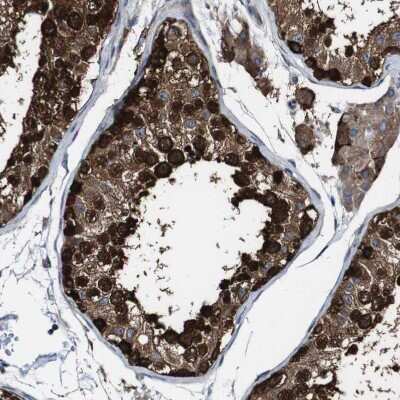 Immunohistochemistry-Paraffin: GALNT8 Antibody [NBP1-81848]