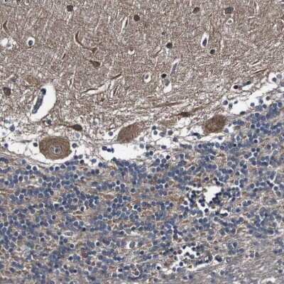 Immunohistochemistry-Paraffin: GALNT8 Antibody [NBP1-81848]