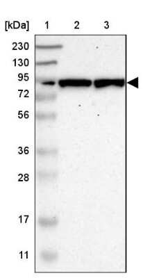 Western Blot: GALNT8 Antibody [NBP1-81848]