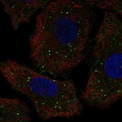 Immunocytochemistry/ Immunofluorescence: GALNT9 Antibody [NBP2-57911]